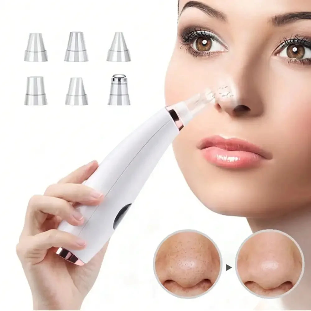 Aspirateur Points Noirs ✨ Rechargeable USB - Pores Nets Instantanément